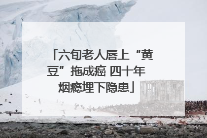 六旬老人唇上“黄豆”拖成癌 四十年烟瘾埋下隐患
